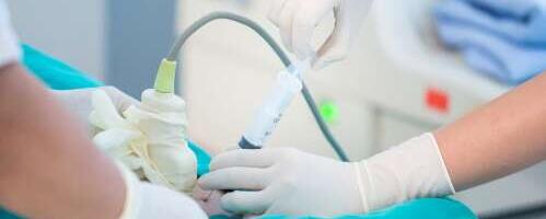 Looteveeuuring ehk amniotsentees