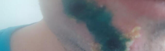 Ohtlik viirus on jõudnud Soome lähedale