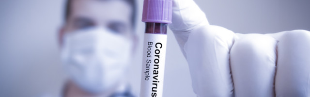 Teadus kohtub argipäevaga: mida me võiksime teada viirustest