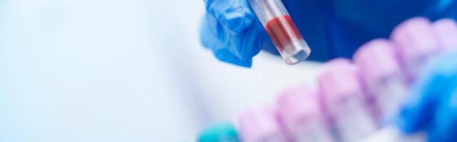 Soomes hakatakse rasedatel katsetama suvel tähelepanu saanud alkoholiteste