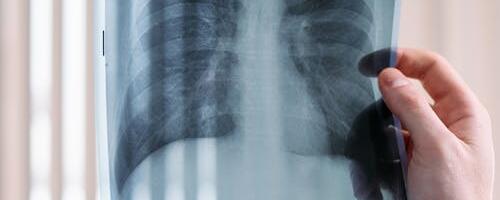 Tõrva Tervisekeskuses alustab 29. mail taas tööd röntgenkabinet