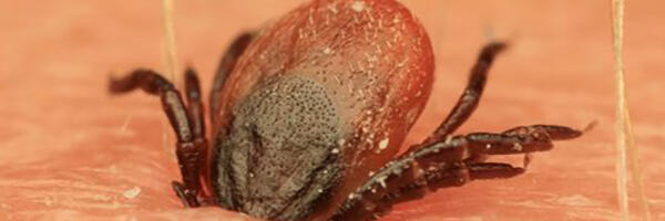 Arstid diagnoosivad Eestis üha enam puukborrelioosi