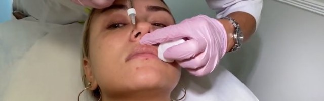 VIDEO | Rannamaja-Ada selgitab, miks ta lasi oma huuli süstida: ma ei taha näha välja nagu Kylie Jenner