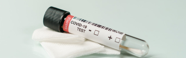 Koroonaviirus Eestis, 12. mai 2021: ööpäevaga lisandus 371 positiivset, suri 4 inimest