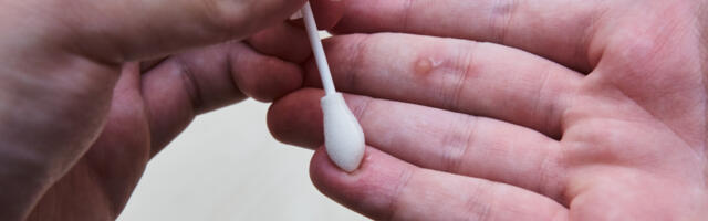 Mis vahe on konnasilmal ja soolatüükal?