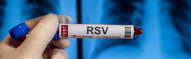 Eakamatel jääb RS-viirus sageli diagnoosimata