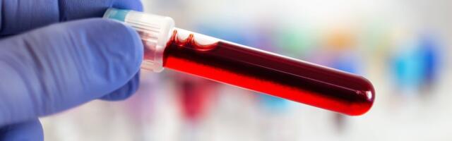 Huvitav katse_ teadlased muutsid siirdatava neeru veregrupi A-st 0-ks