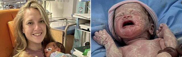 Üliharuldase haiguse tõttu sündis beebi kehast väljaspool asuvate organitega