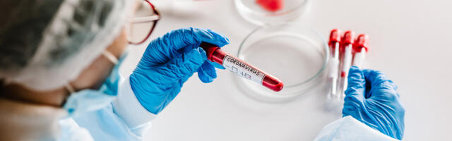 Eesti 6. veebruari 2022 koroonaviiruse numbrid - 7048 uut positiivset, haiglas 381 patsienti