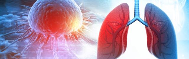 FDA kinnitas Johnson & Johnsoni uue keemiaravivaba kopsuvähiravi