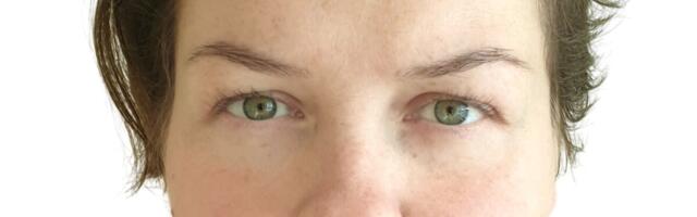 Ida-Viru keskhaiglaga liitus ortopeed Triin Tammeleht