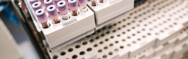 Laboriteenuste piirhinna kärpimine teeb haiglatele muret