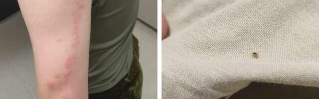 Kaitseväe vahipataljonis vohavad juba pool aastat lutikad. Ülem: ajateenijatel tuleb hügieeni eest rohkem hoolitseda