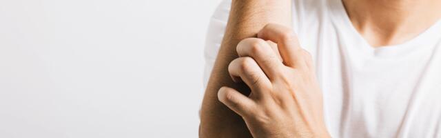 Allergiline reaktsioon või sügelised? Mida peaks iga lapsevanem teadma?