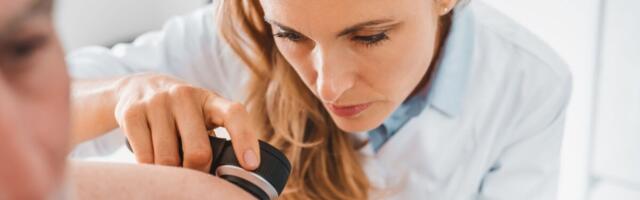 Melanoomi haigestumine on kiirelt kasvanud