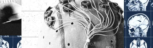 China Is Building a Brain-Computer Interface Industry