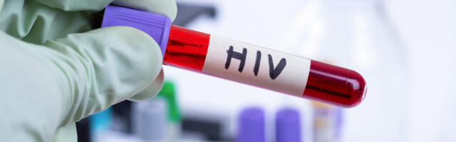 Spetsialistid: HIV ei ole enam sõltlaste haigus, positiivseid diagnoose saavad 30 aastates heal järjel pereinimesed, kes on kunagi juhusuhtes olnud