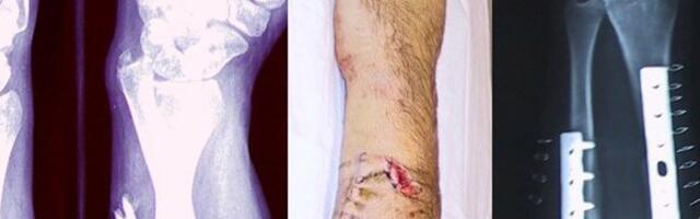 Loomakarvadest võib saada uus materjal luude parandamiseks