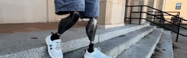 Moodne põlveprotees aitab Ukraina sõduritel kiiremini tagasi rindele jõuda