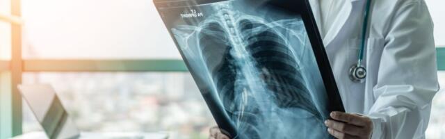 WHO: Tuberkuloosisurmade arv kasvas pandeemia ajal