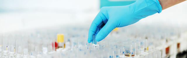 Koroonaviiruse seis Eestis 29. jaanuari 2022 seisuga: 7124 uut nakatunut ja 302 patsienti haiglas