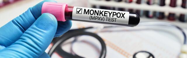 Ekspertkomisjon soovitab ahvirõugete ennetamiseks vaktsineerida haigestunute lähikontaktseid