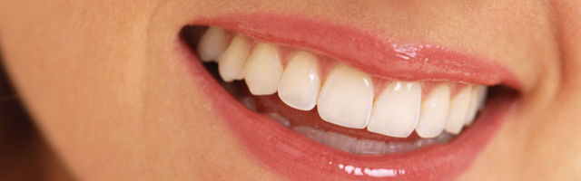 8 toiduainet tervete hammaste heaks