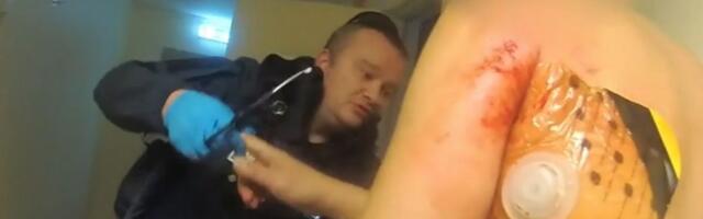 VIDEO | Vaata, millega heitlevad politseimeedikud, kel elupäästvat abi anda ei lubata