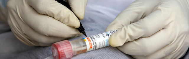 Kas koroonaviiruse antikehatestide põhjal võiks immuunpasse väljastada?