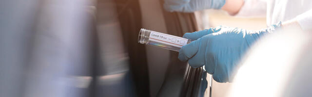 Terviseamet otsustas kiire omikroni leviku tõttu muuta lähikontaktsete kaardistamist