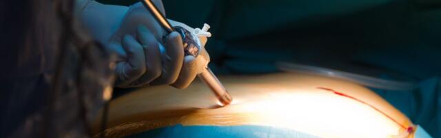 Kulude suur kasv jahmatas