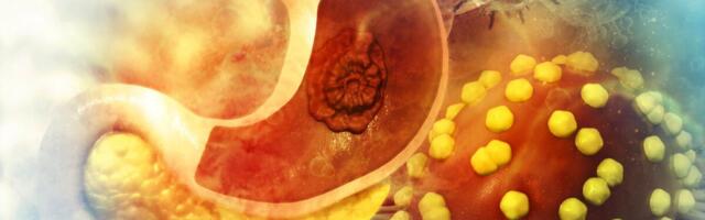 Erakordselt kõrge trombotsüütide arv võib viidata ka vähile