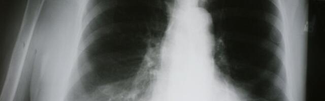 Madis Veskimägi KOKist perearsti töös