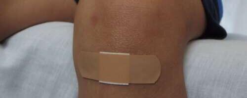 Kas oskad haavu õigesti puhastada?