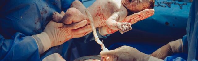 USKUMATU STATISTIKA ⟩ Arst suunas raseda keisrilõikele, et sünnitus tema vaba päeva ei segaks