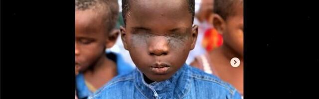 PILDID ⟩ Lugu poisist, kes kaotas kurja naise tõttu nägemise