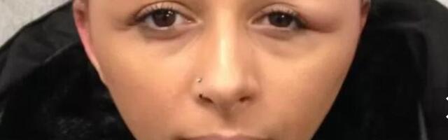 NAPP PÄÄSEMINE ⟩ Juuksed mustaks värvinud naine oleks peaaegu surnud