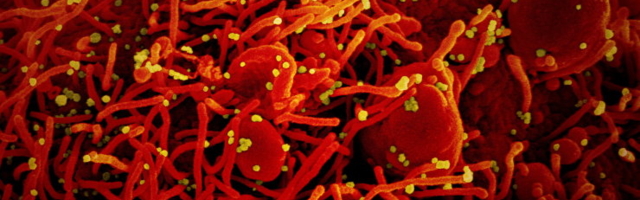 Eesti ja Norra teadlased avastasid vanade ravimite koroonavastase toime