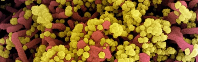 100 viiruseuurijat: COVID-19 jääb veel aastateks ringlema