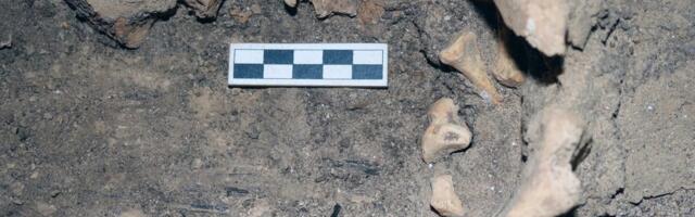 FOTOD | Oh õudust! Vana-Egiptuse naise vaagnast avastati hammastega kasvaja