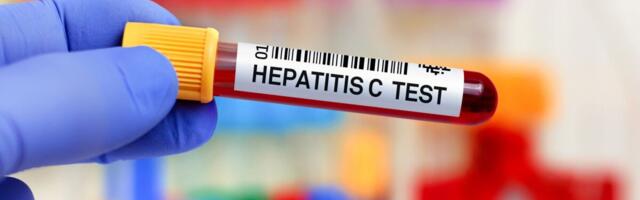 Soome sõelub ka sisserändajate C-hepatiiti