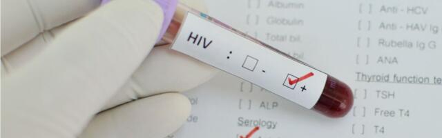 TAI ekspert: Eestis on kõrge HIV juhtude arv olenemata põgenikest