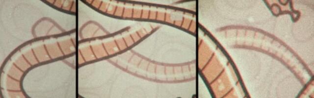 Alternatiivsed ravimeetodid: Ivermektiini ja Fenbendasooli protokoll vähi ravis tõstab teadlaste tähelepanu