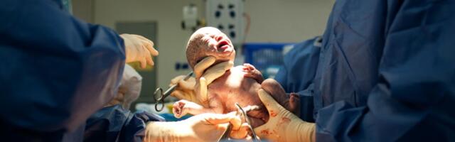 Telefonivalgel tehtud keisrilõige põhjustas beebile tõsise trauma