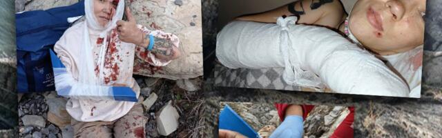 Eesti kodanik jäi pärast Venemaal kaljult kukkumist ellu. „Kõige hirmsam oli neli sekundit vabalangemist ja pea äralöömine“