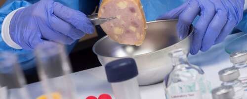 Mis on listerioos ja mida teha nakatumise vältimiseks?