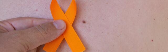 Melanoomi avastatakse Eestis järjest rohkem, eriti tööealistel inimestel