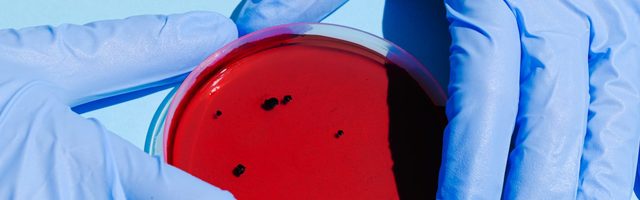 Vaatame saadaolevale infole näkku: kas koroonaviiruse test on pettus?