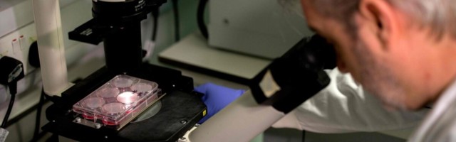 Tumeaine su kehas – osa inimorganismis kihavast elust pole justkui olemaski