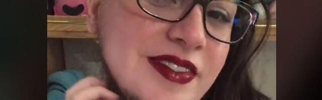 Habemega naine: mul võttis aastaid, et oma eripäraga leppida